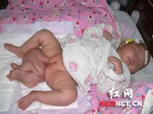 支那の新生児の５％以上が障害児・奇形児