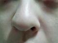 ピュアイオン鼻1