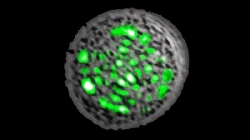 living-laser-stem-cell-jellyfish-nature-photonics1-300x168.jpg