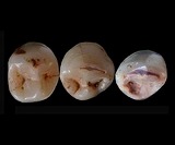lower-premolars-and-canine-teeth-qesem-cave-israel-lg.jpg